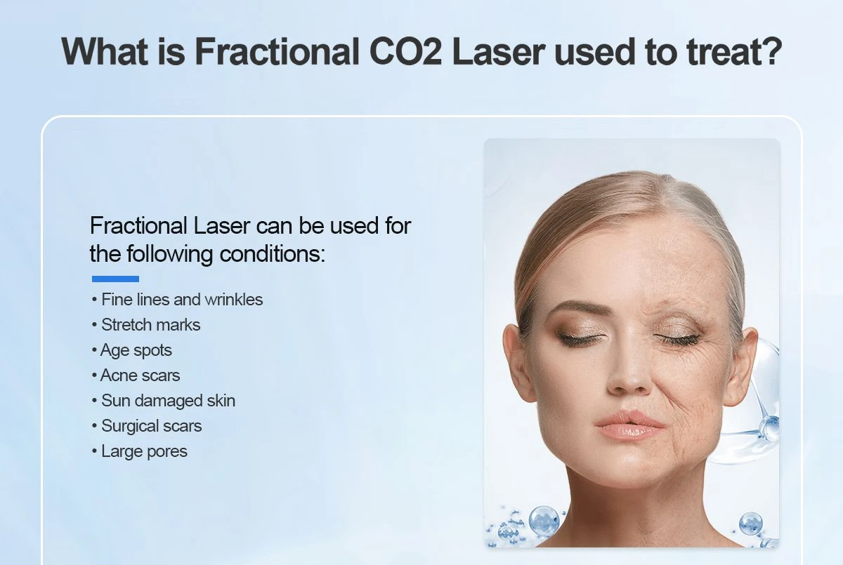 CO2 fractional laser skin care system